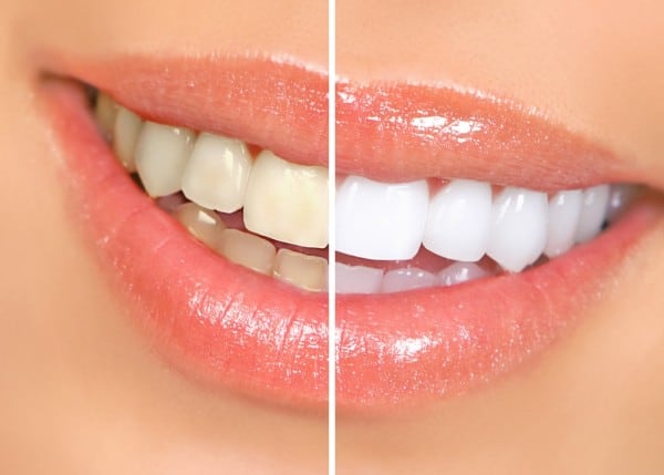 Top 10 Beauty Tips for Looking Flawless on Your Wedding Day